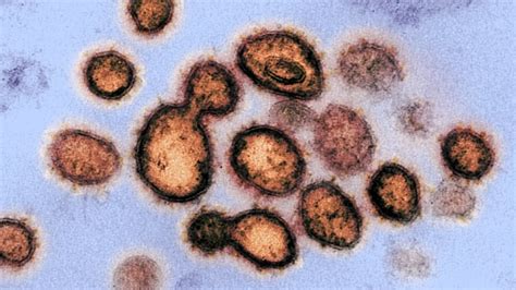 coronavirus metal box|Study suggests new coronavirus may remain on .